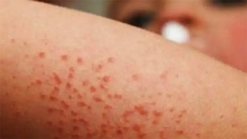 imagen recuadro imagen recuadro