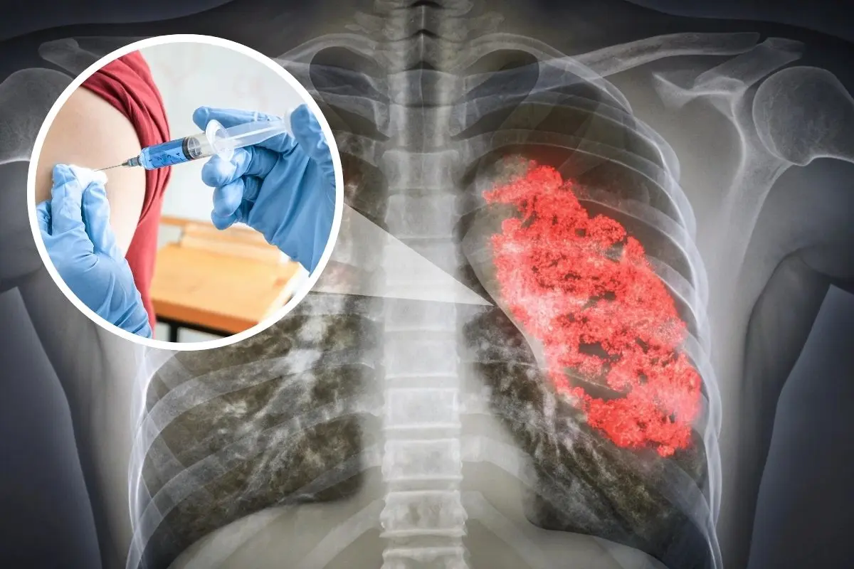 Buscan prevenir casos de neumonía en Coahuila / Foto: Composición de Canva