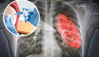 Coahuila registra alza en casos de neumonía, este es el plan preventivo previo al invierno