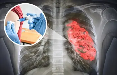 Coahuila registra alza en casos de neumonía, este es el plan preventivo previo al invierno