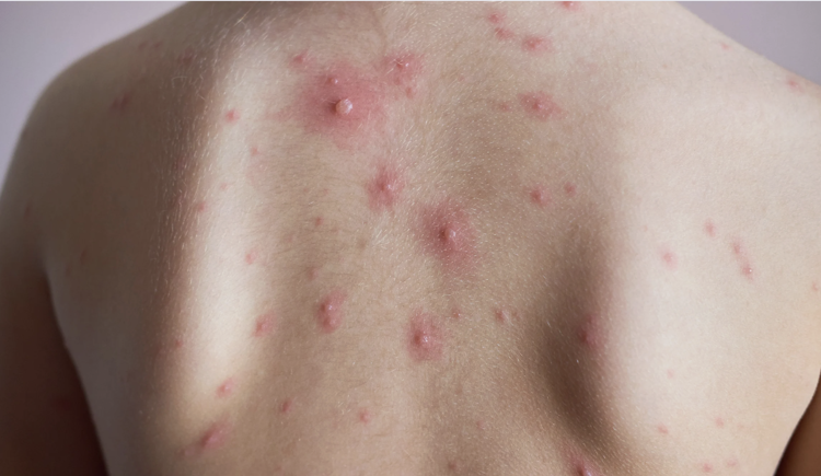 imagen-cuerpo imagen-cuerpo