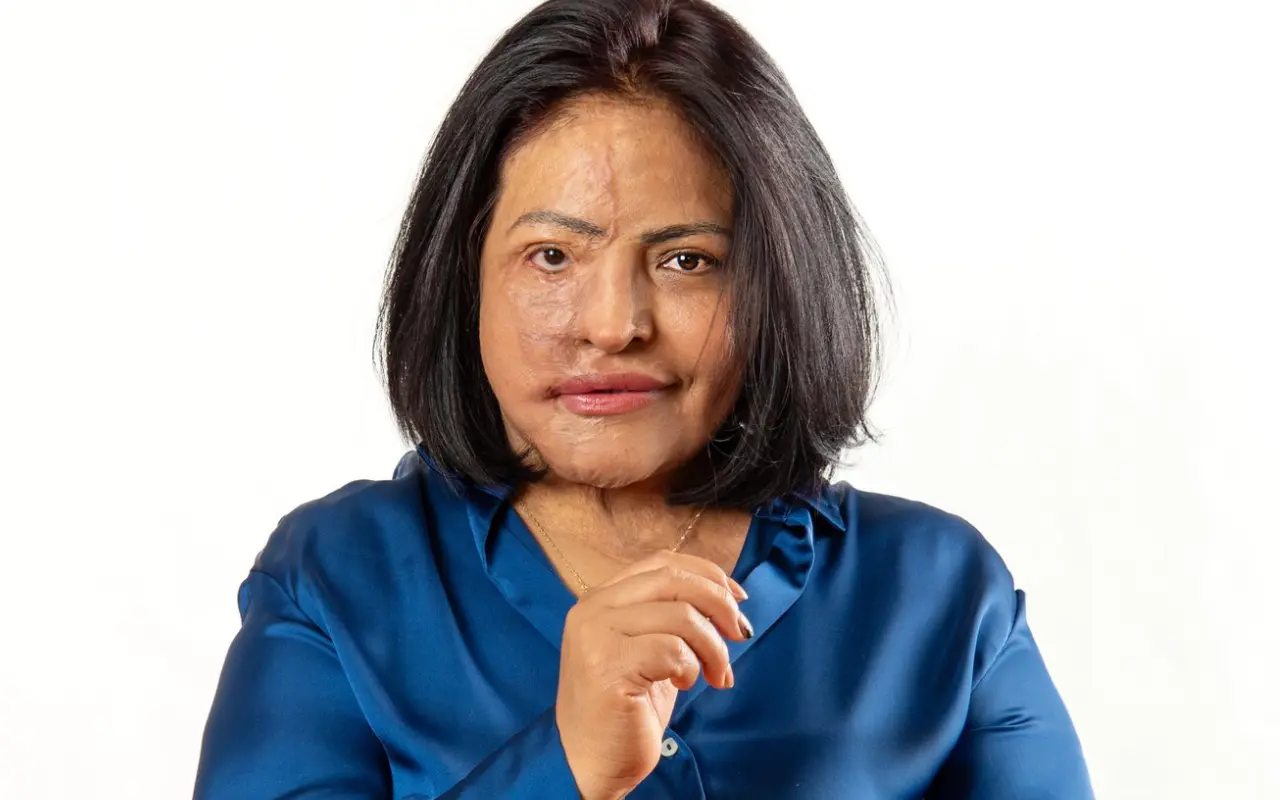 Carmen Sánchez, sobreviviente de un ataque con ácido, encabeza la lucha para tipificar la violencia química como delito en el Estado de México. Foto: X/ @CarmenAnchez (Canva)