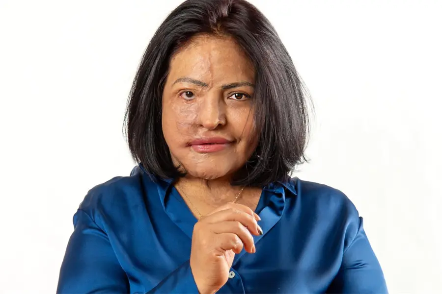 Edomex encabeza casos de ataques con químicos contra mujeres en México y buscan tipificar esta violencia