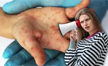 ¡Atención mamás y papás! este virus se propaga rápido y pone en riesgo a los más pequeños