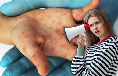 ¡Atención mamás y papás! este virus se propaga rápido y pone en riesgo a los más pequeños