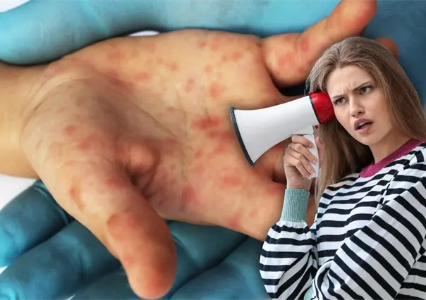 &iexcl;Atenci&oacute;n mam&aacute;s y pap&aacute;s! este virus se propaga r&aacute;pido y pone en riesgo a los m&aacute;s peque&ntilde;os