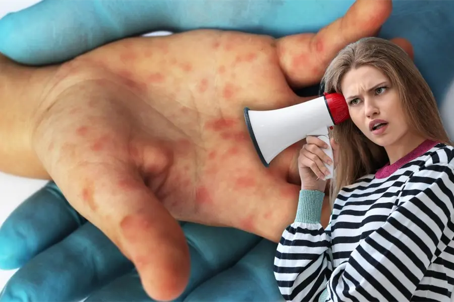 ¡Atención mamás y papás! este virus se propaga rápido y pone en riesgo a los más pequeños