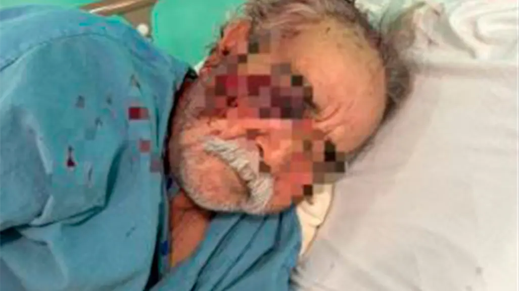 PGJE avanza investigación sobre agresión a profesor en La Paz: aún no hay personas identificadas