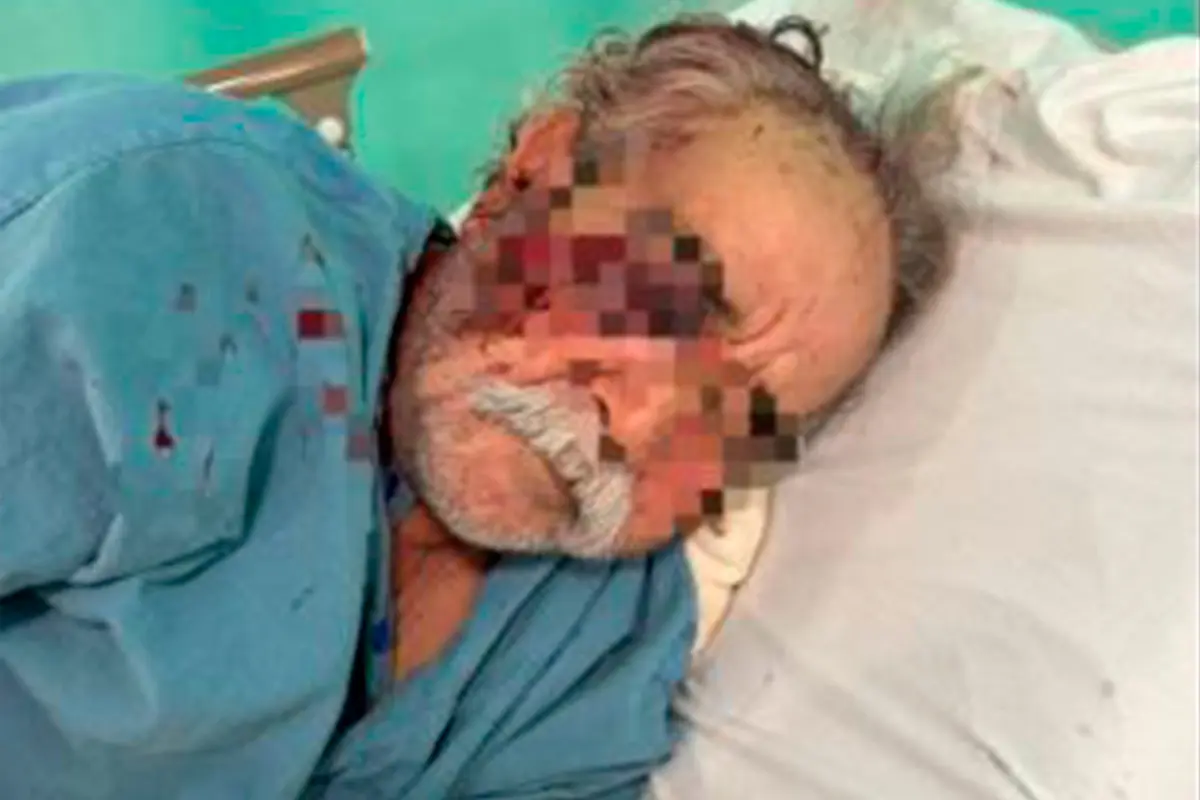 El profesor agredido en La Paz tuvo lesiones graves, incluso, perdió un ojo. Foto: Homero Amao Avilés.