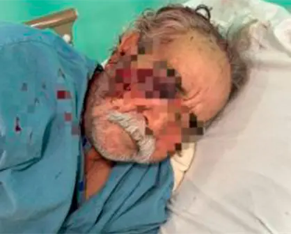 PGJE avanza investigación sobre agresión a profesor en La Paz: aún no hay personas identificadas