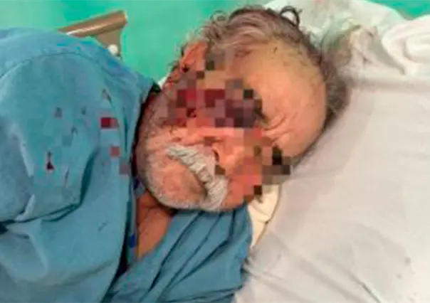 PGJE avanza investigación sobre agresión a profesor en La Paz: aún no hay personas identificadas