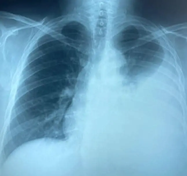 imagen recuadro Foto: Cortesía Dr. Guillén Ortega