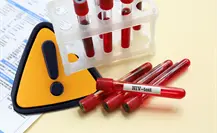 Contagios de VIH aumentan drásticamente en Coahuila; autoridades encienden alertas Contagios de VIH aumentan drásticamente en Coahuila; autoridades encienden alertas