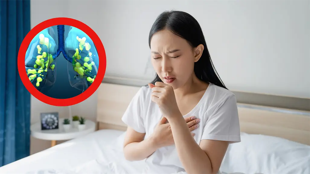 Frente Frío 14: Especialistas advierten aumento de enfermedades pulmonares por bajas temperaturas