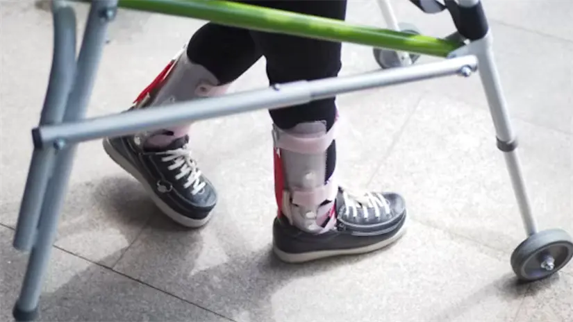 niño con discapacidad Foto: Unsplash