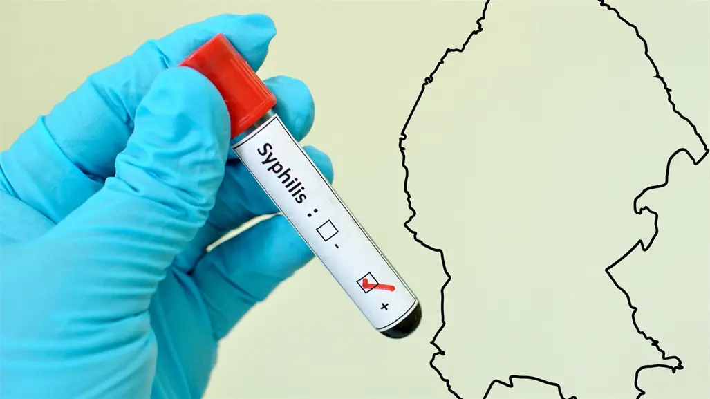 Coahuila suma más de mil casos de sífilis; ocupa el séptimo lugar nacional