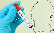 Coahuila suma más de mil casos de sífilis; ocupa el séptimo lugar nacional Coahuila suma más de mil casos de sífilis; ocupa el séptimo lugar nacional