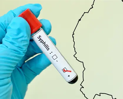 Coahuila suma más de mil casos de sífilis; ocupa el séptimo lugar nacional