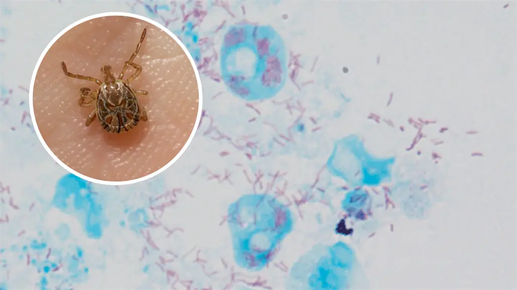 Rickettsia en Coahuila rebasa casos de 2024; estos son los municipios con mayor incidencia