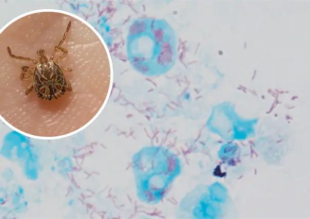 Rickettsia en Coahuila rebasa casos de 2024; estos son los municipios con mayor incidencia