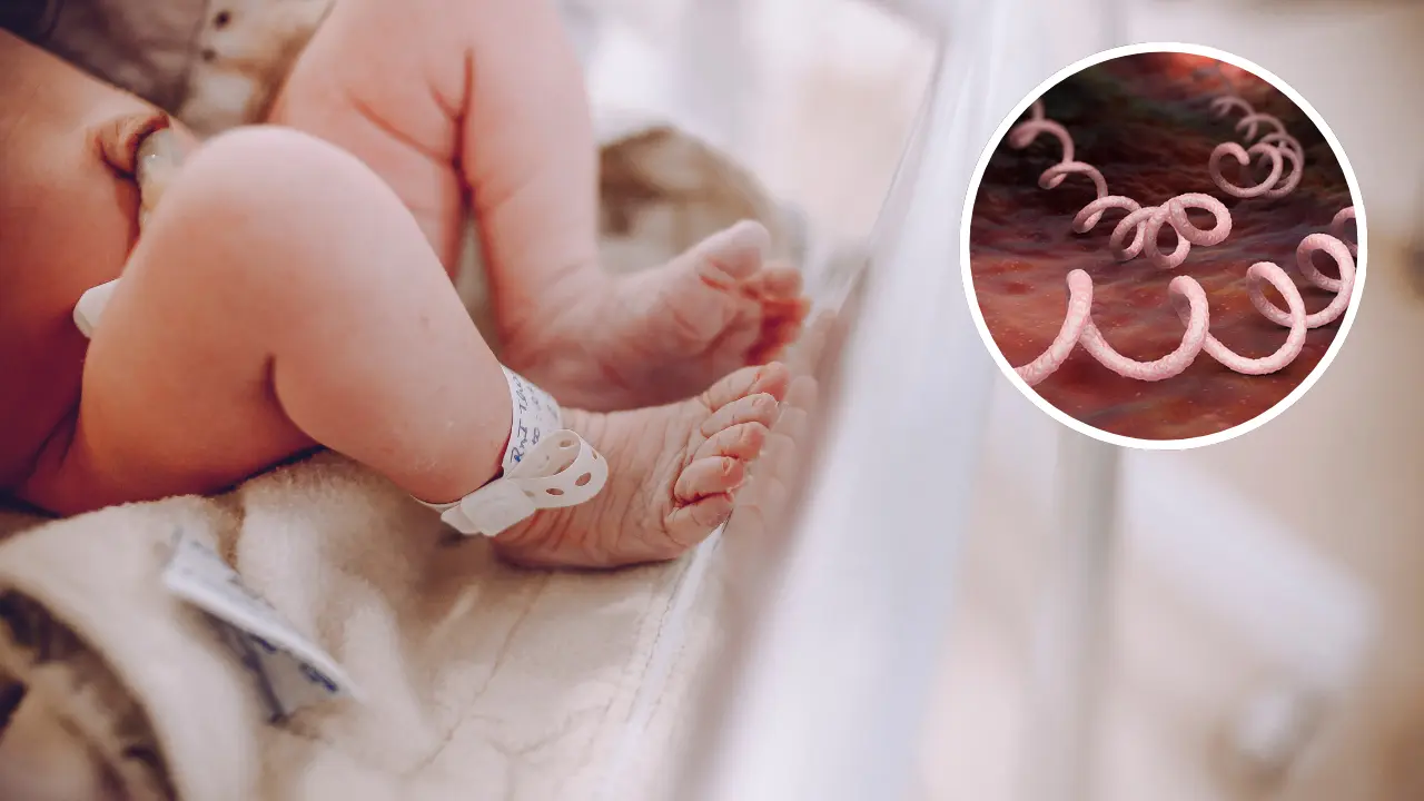 La sífilis es una enfermedad prevenible y tratable, pero requiere acción inmediata./Foto: Blog Hospital Ángeles/ Cava