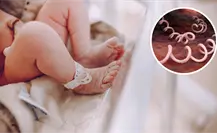 Coahuila registra 32 casos de sífilis en bebés, ¿qué es esta enfermedad? Coahuila registra 32 casos de sífilis en bebés, ¿qué es esta enfermedad?