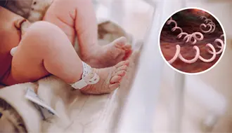 Coahuila registra 32 casos de sífilis en bebés, ¿qué es esta enfermedad?