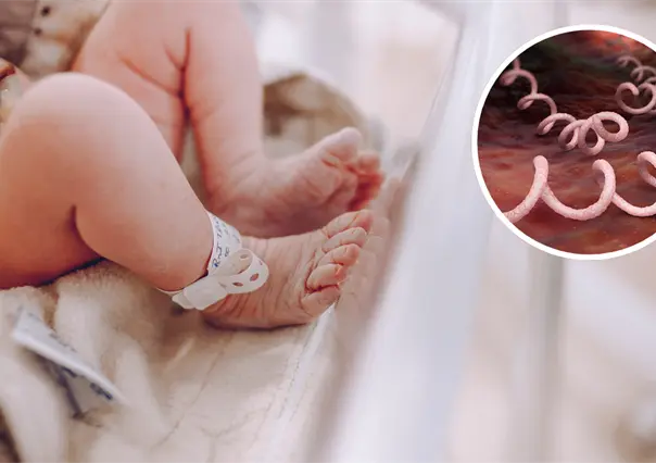 Coahuila registra 32 casos de sífilis en bebés, ¿qué es esta enfermedad?