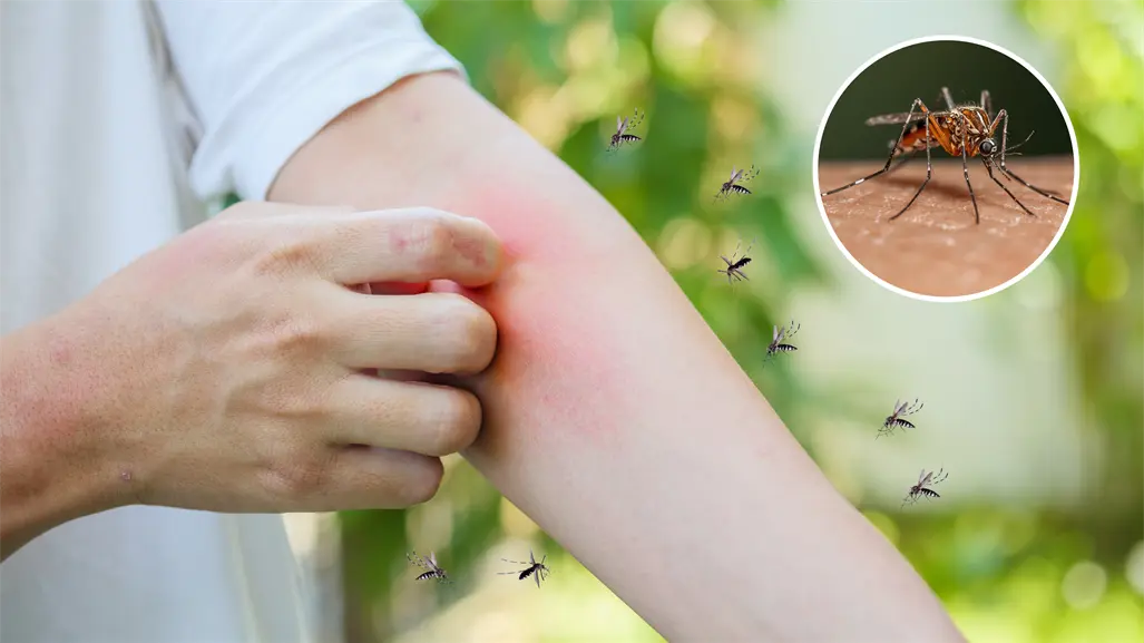 La Paz concentra el mayor número de casos de dengue en BCS