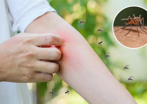 La Paz concentra el mayor número de casos de dengue en BCS