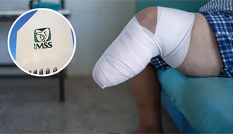 IMSS Coahuila realiza casi mil amputaciones al año, esta es la causa