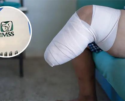 IMSS Coahuila realiza casi mil amputaciones al año, esta es la causa