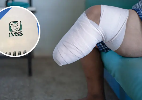 IMSS Coahuila realiza casi mil amputaciones al año, esta es la causa