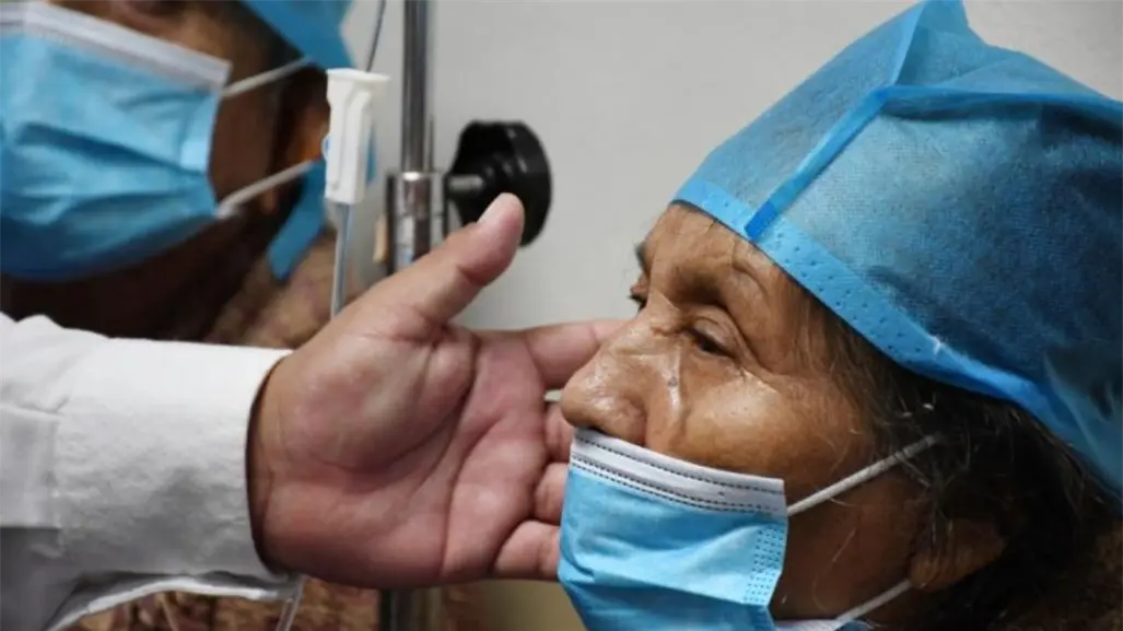 Jornada de cirugías de catarata en Valladolid: 83 pacientes recuperan su visión en Yucatán