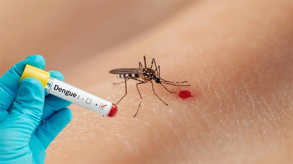 Dengue con signos de alarma es el tipo de caso más frecuente en el estado durante el 2025