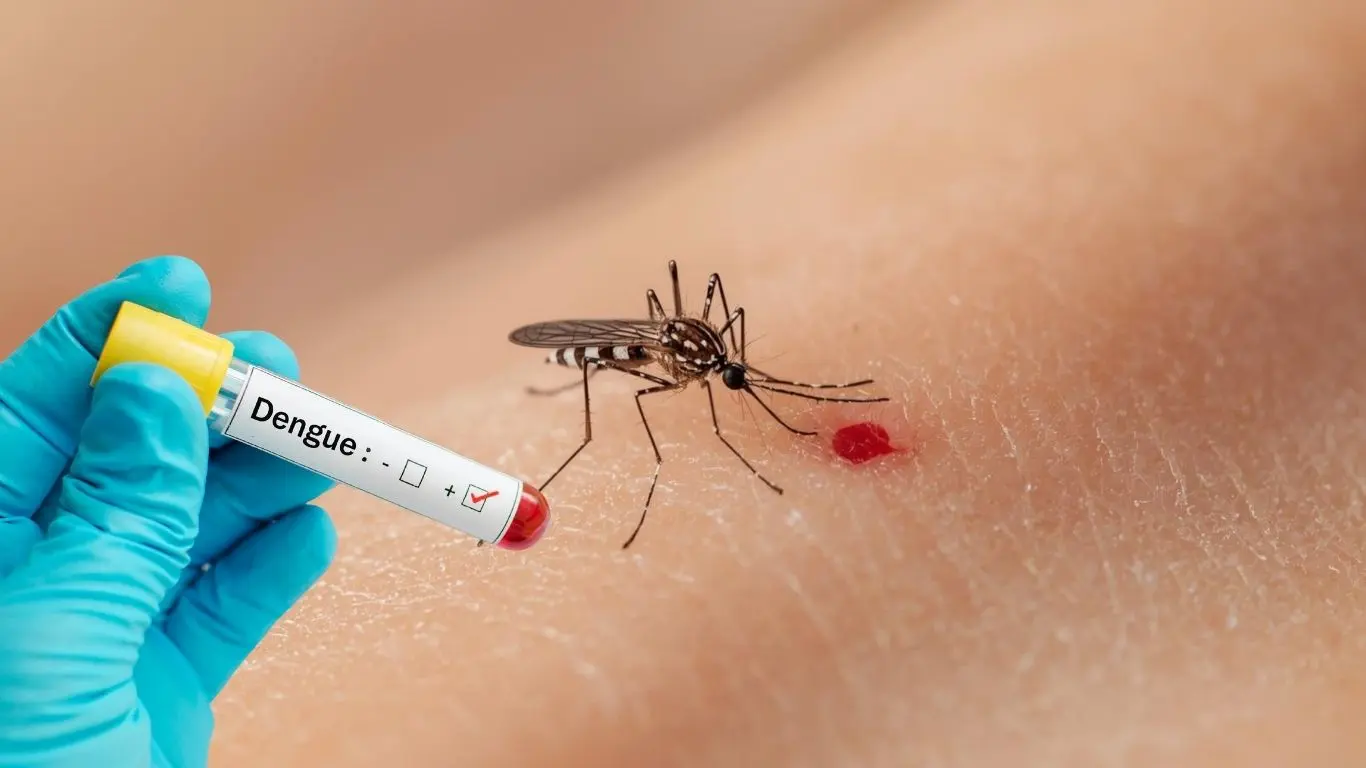 Yucatán registró 80 casos de dengue no grave, 99 casos de dengue con signos de alarma. Foto: Canva / Adity Cupil