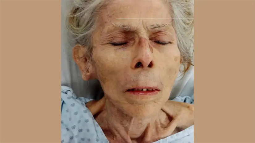 imagen recuadro La abuelita permanece bajo observación clínica | Foto: redes Matamoros