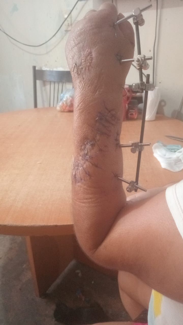 imagen recuadro