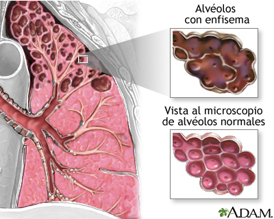 imagen recuadro